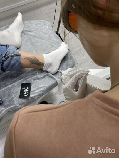 Лазерное удаление тату и татуажа