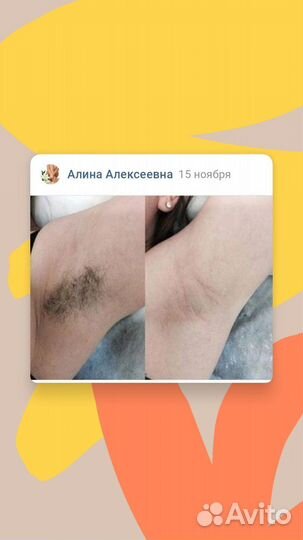 Восковая депиляция