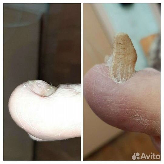 Подолог(химки,куркино,новогорск),подолог(выезд)