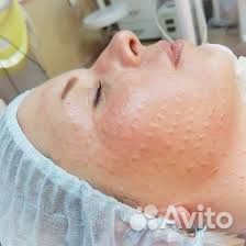 Косметолог Чистка лица, уколы красоты