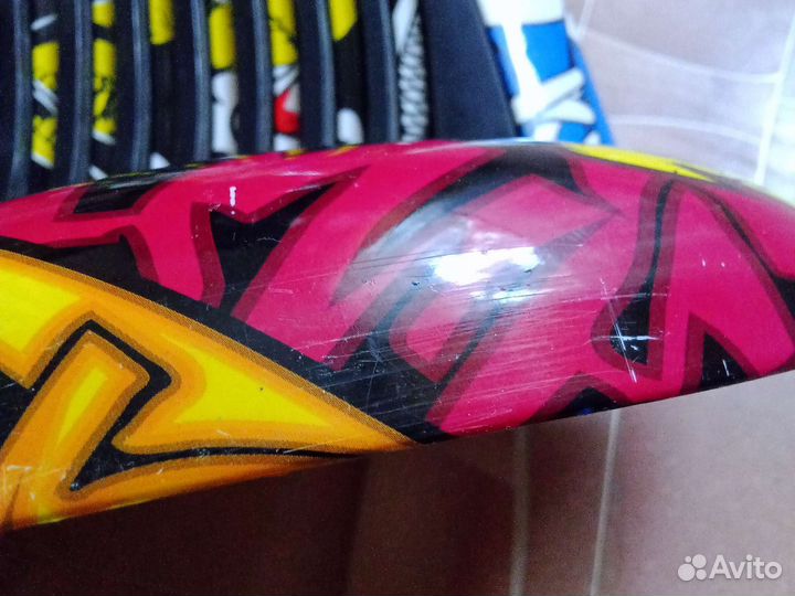 Корпус гироскутера