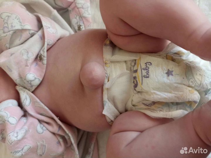 Бандаж от пупочной грыжи для новорождённых