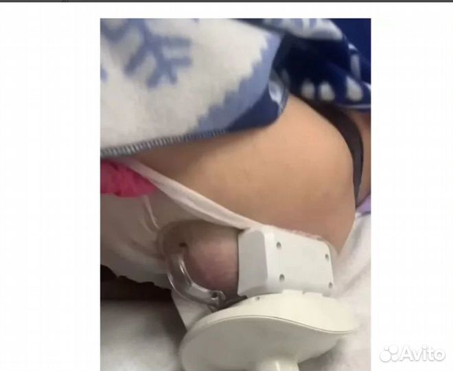 Удаление жира в Челябинске