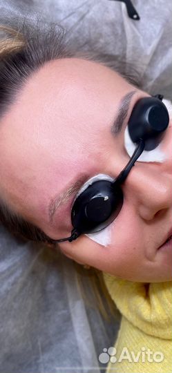 Удаление тату удаление тутажа лазером