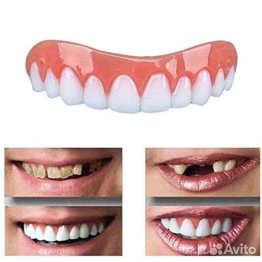 Виниры для зубов Perfect Smile верх, низ. Доставка