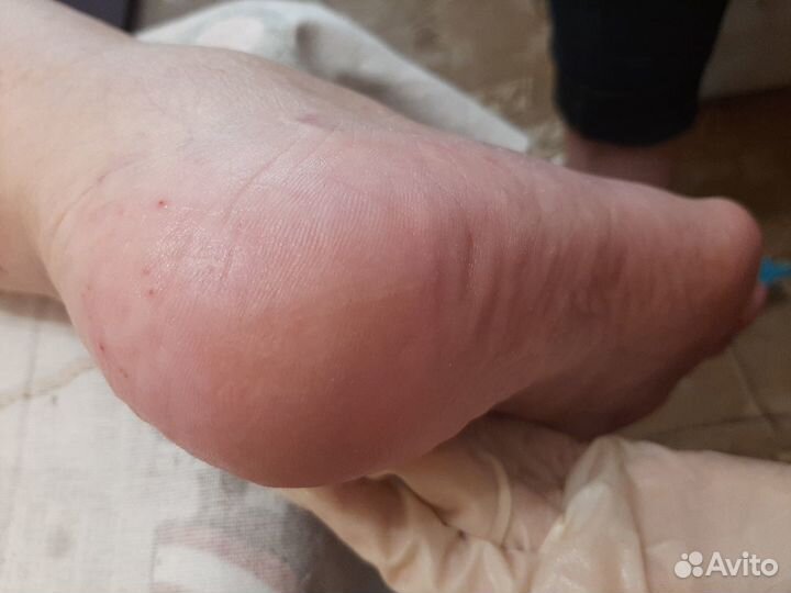 Педикюр (медицинский) пожилым