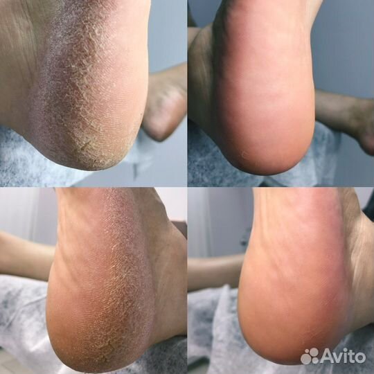 Мастер маникюра и педикюра