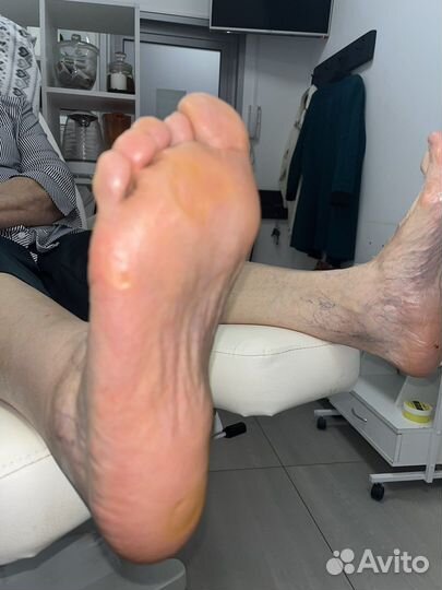 Лечебный педикюр выезд на дом подолог