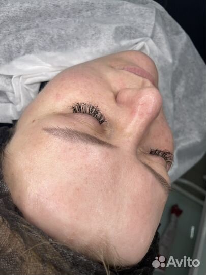 Чистка лица