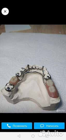 Изготовление и ремонт зубных протезов