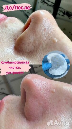 Услуги косметолога