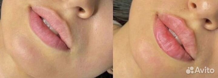 Услуги косметолога