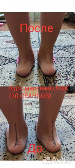 Детский массаж,Войта, Бобат,лфк, логомассаж