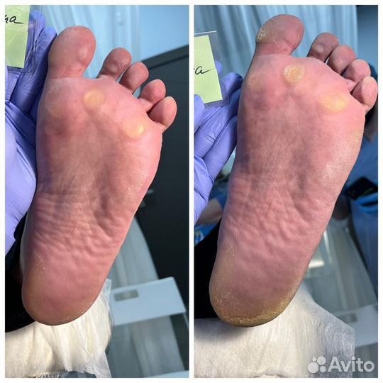 Маникюр Педикюр Подология