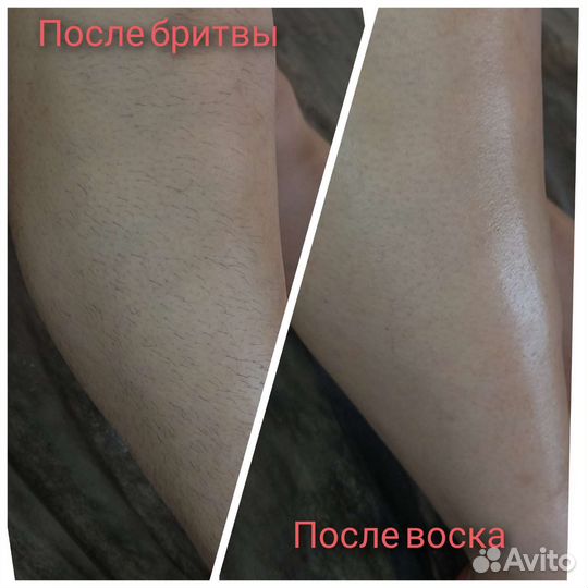 Депиляция воск/сахар