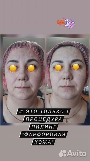 Услуги косметолога