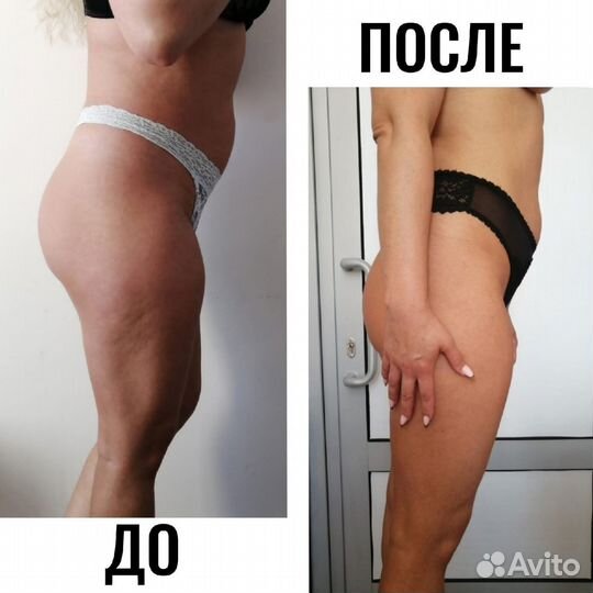 Биоэнергетический массаж