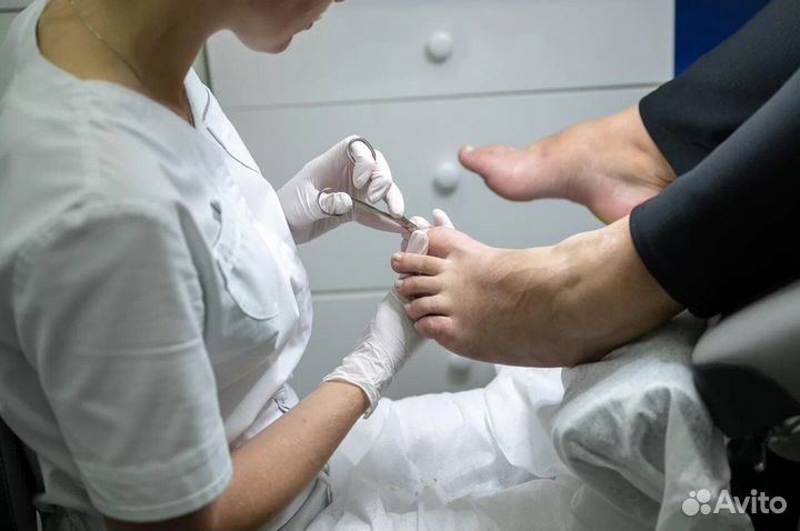 Подолог, коррекция вросшего ногтя, лечение трещин