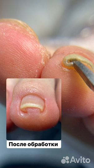 Подолог с выезжом на дом