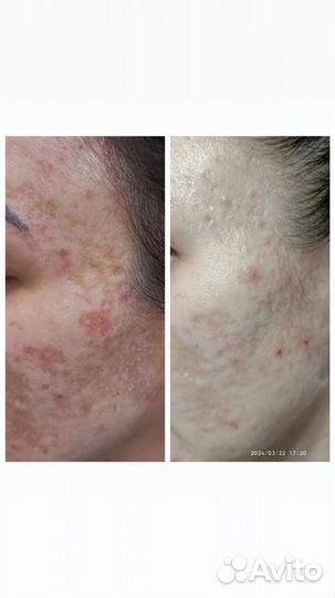 Косметик-эстетист. Аппаратная косметология