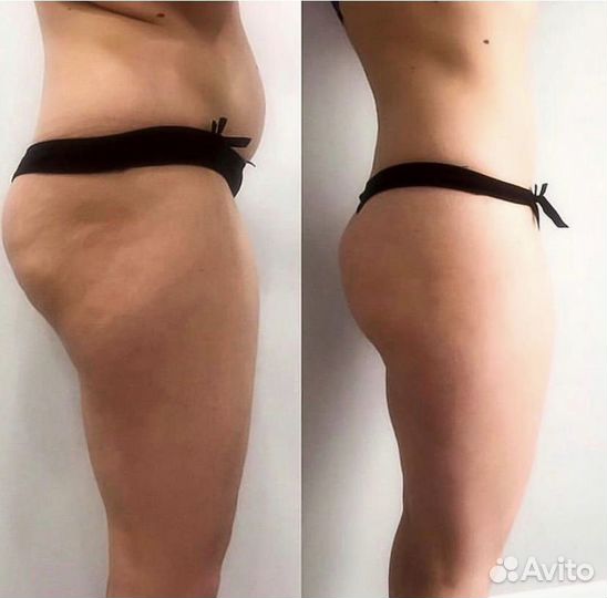 Массаж Реутов, Новокосино, Новогиреево, Балашиха