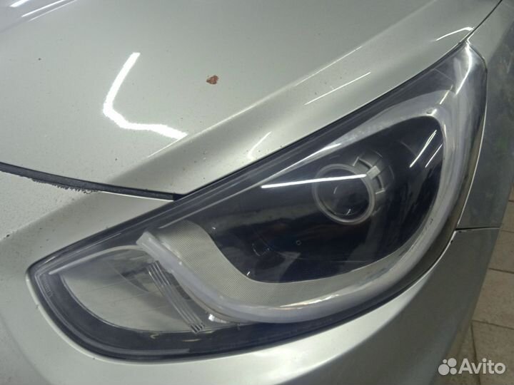 Фары Hyundai Solaris