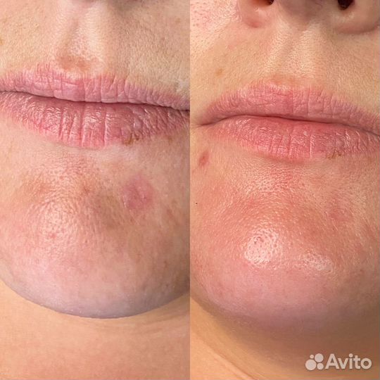 Услуги косметолога