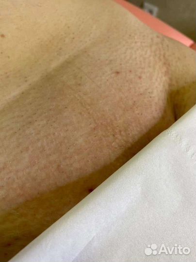 Восковая и сахарная депиляция