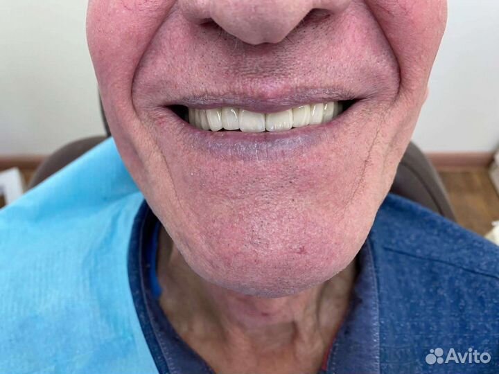 Обучение протезированию зубов для всех с нуля