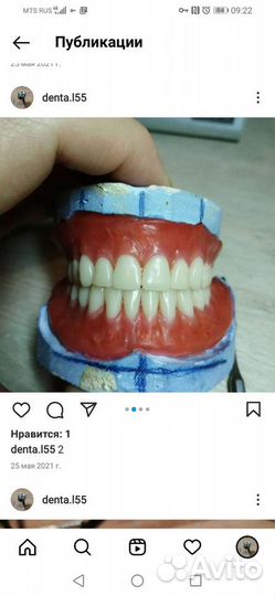 Зубные протезы с выездом на дом. Протезирование