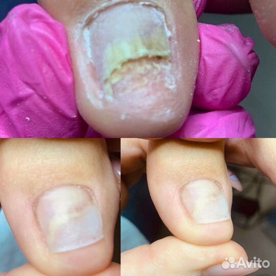 Мастер медицинского педикюра