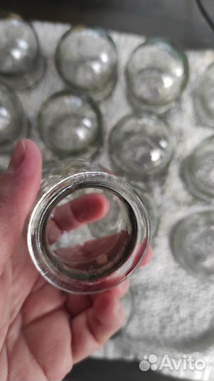 Медицинские вакуумные банки СССР цена за все