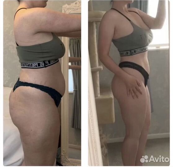 Супер Быстрое Сжигание Жира Криолиполиз 4D