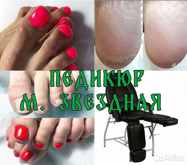 Смарт педикюр. Метро звёздная