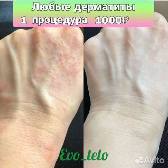 Холодная плазма
