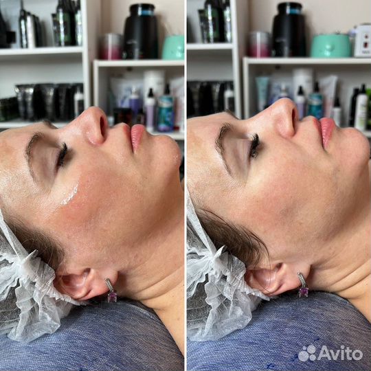 Сахарное моделирование тела, массаж