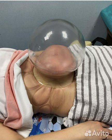 Большая вакуумная банка для живота новая