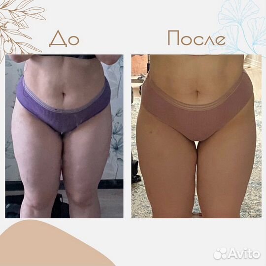 Lpg-массаж лица и тела