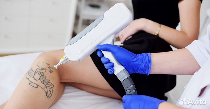 Лазер для удаления тату (выставочный образец)