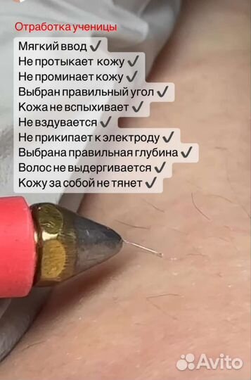 Электроэпиляция