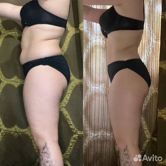 Антицеллюлитное обёртывание