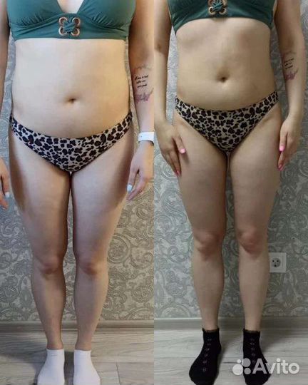 Антицеллюлитный массаж и коррекция фигуры