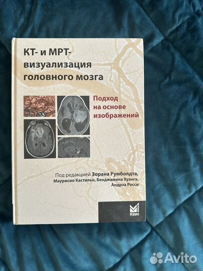 Книга кт-мрт визуализация головного мозга