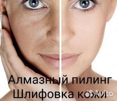 Дарсонвализация