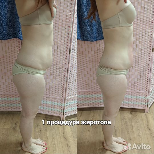 Жиротоп,топим Ваш жирок,Коррекция фигуры,похудение