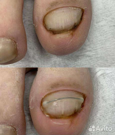 Мастер медицинского педикюра