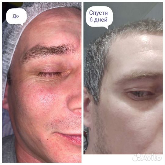 Холодная плазма