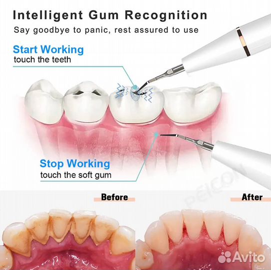 Ультразвуковой очиститель зубного налета