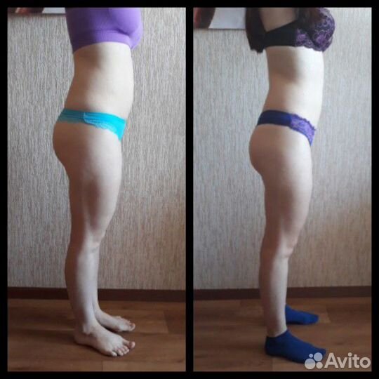 Массаж Антицеллюлитный