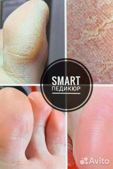 Маникюр, покрытие гель-лак, Smart педикюр